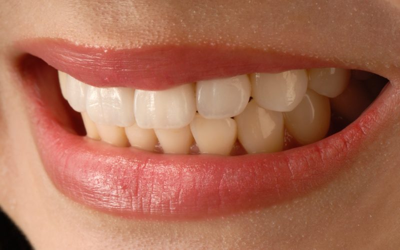Richmond Dentist