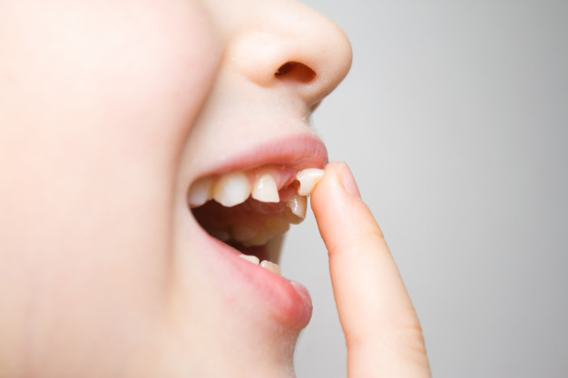 Tooth Loss Epping Dental