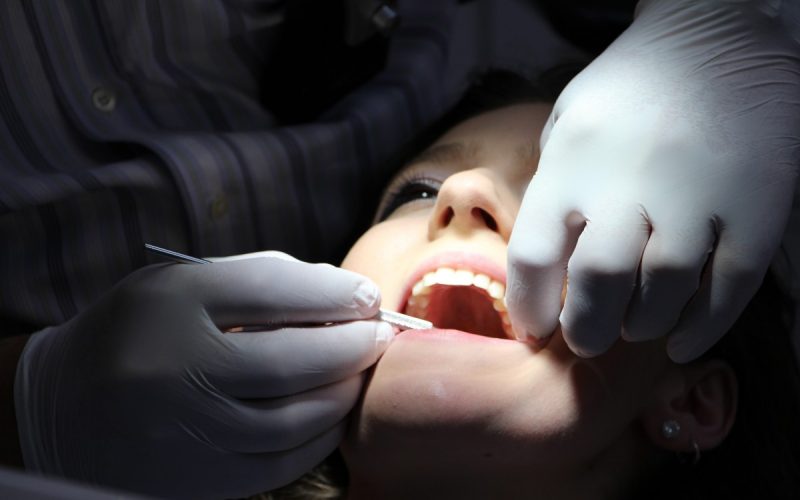 wisdom teeth