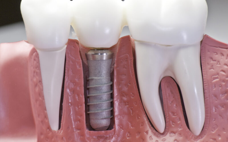 Gum & Dental